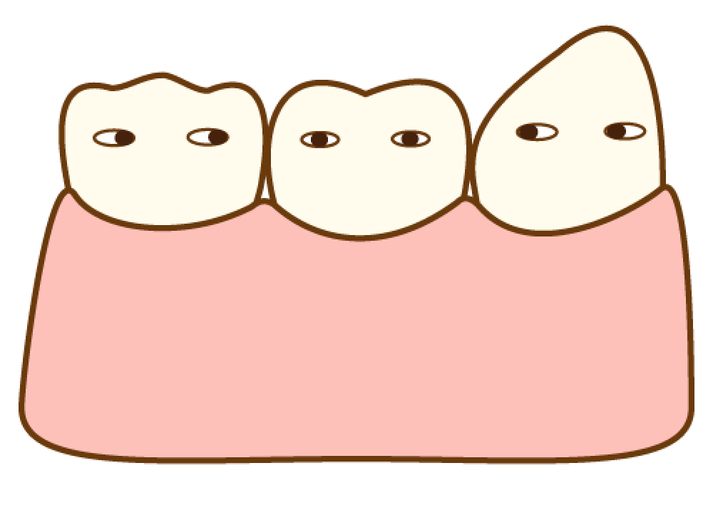 歯の種類