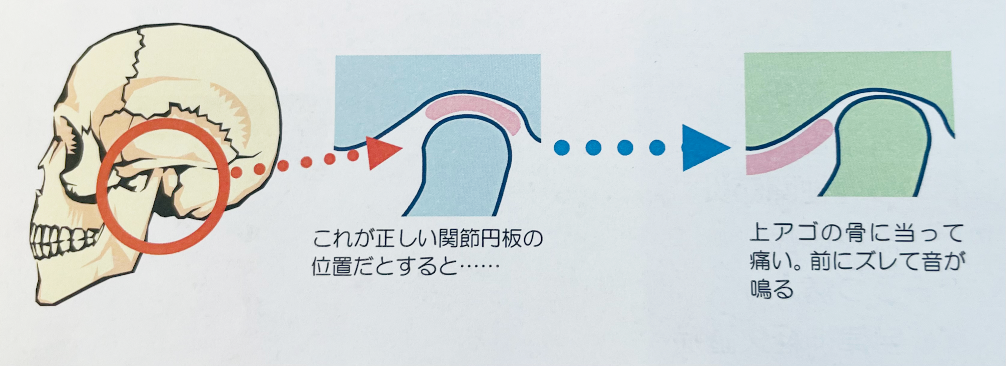 井ビシ歯科医院　顎関節症