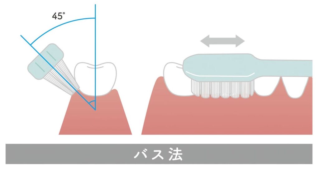 井ビシ歯科医院　バス法