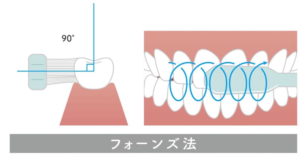 井ビシ歯科医院　フォーンズ法