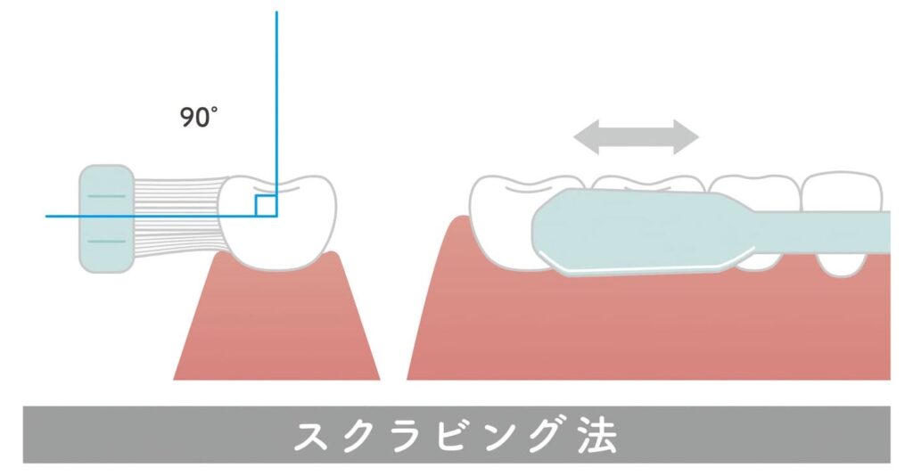 井ビシ歯科医院　スクラッピング法