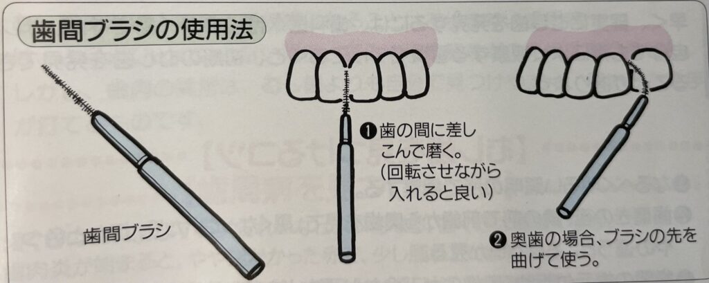 井ビシ歯科医院　歯間ブラシ